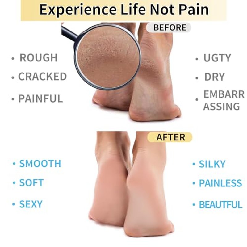 Moisturizing Gel Socks for Soft, Cracked Feet - Reusable Foot Care