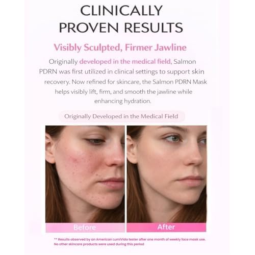 Salmon DNA PDRN Anti-Aging Jelly Gel Mask | Overnight Firming & Hydrating Face Mask for Elasticity & Glow | Korean Skincare with Niacinamide, Peptides & Hydrolyzed Collagen | 4 Pack