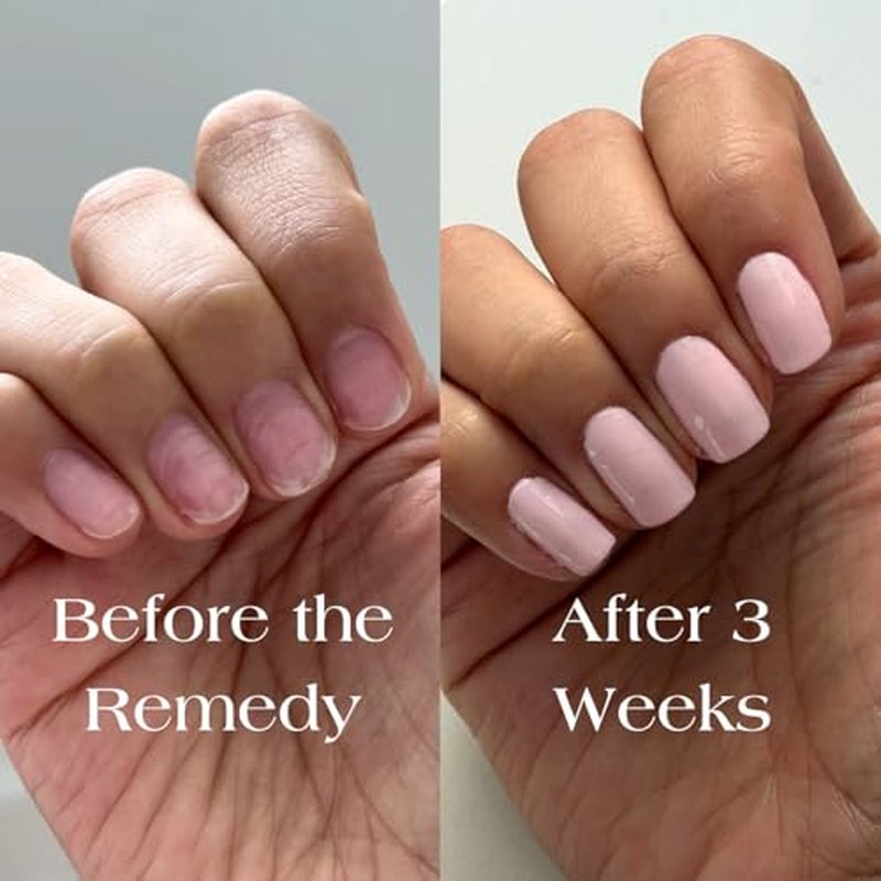 Botanist The Remedy Nail Strengthening Polish - Repair Damaged Nails