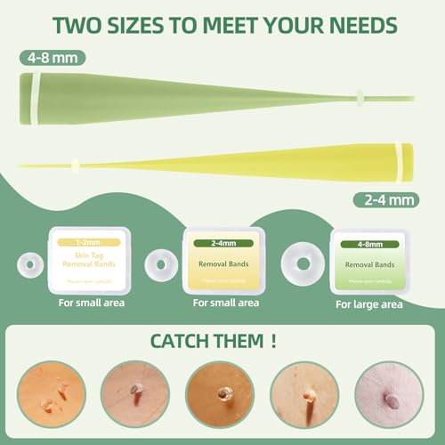 Dual-Size Skin Tag Removal Kit – At-Home Ligation System