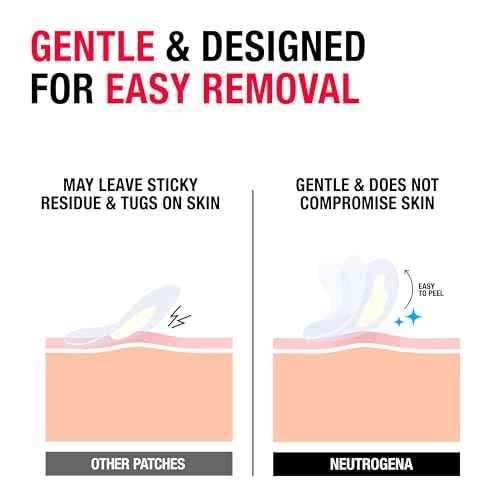 Neutrogena Sensitive Skin Blemish Patches, Acne Patches for Sensitive Skin, Hydrocolloid Treatment Visibly Shrinks Pimples Overnight, 2 Sizes, 30 Count