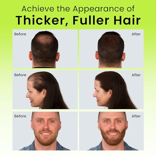 ECLIPSE Hair Fibers Medium Brown 15g - Instant Thicker Hair