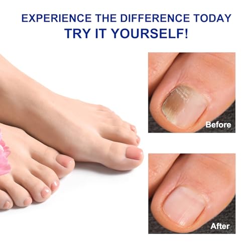 Toenail Treatment Patches - 32 Pc Extra Strength Overnight Repair