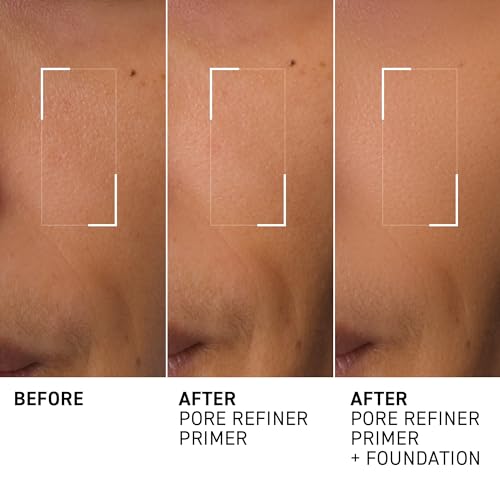 MoistureGlow¢â Plumping Lip Serum