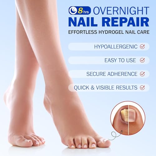 Frovetani Overnight Nail Treatment Patches - Extra Strength Repair (21 Pcs)