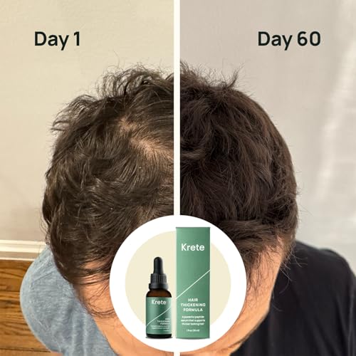 Krete Hair Thickening Formula ? Supports Thicker-Looking Hair for Men ? 1 fl oz