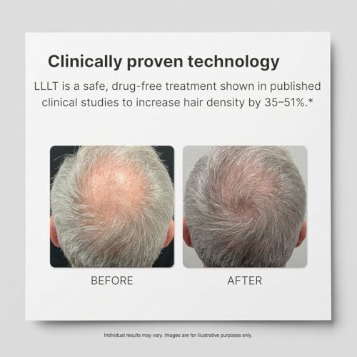 Xtrallux Super Plus Hair Growth Laser Cap - 276 Lasers, FDA Cleared