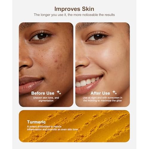 Lemon Turmeric Kojic Acid Soap, 4 Pcs Turmeric Soap Bar Infused with Hyaluronic Acid, Vitamin C£¬E, Shea Butter for Face & Body Deeply Clean, 3 Foam Nets