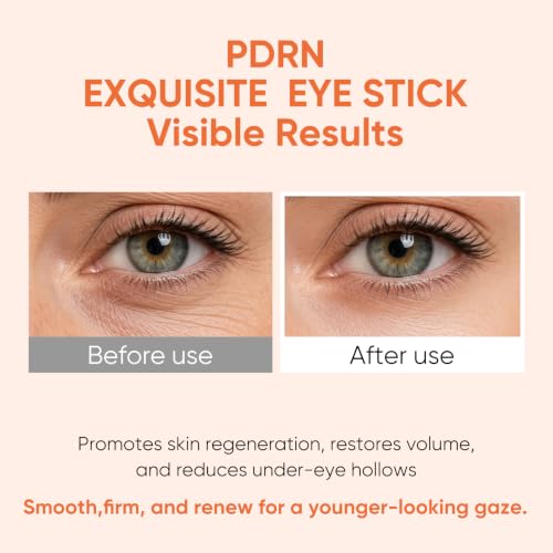 IREV PDRN Essence Stick Balm - All-in-One Anti-Wrinkle Treatment