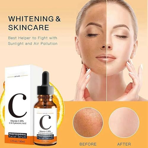 Vitamin C Face Serum, Vitamin C Serum For Face, 100% Pure Vitamin C Serum For Facial Moisturizing, Firming Skin, And Even Skin Tone - 30 ml