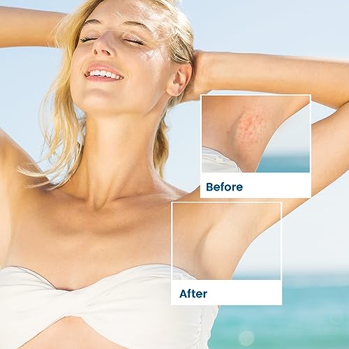 Shave Razor Bump Ingrown Hair Aftershave: Treatment Lotion for Sensitive Zone - Men & Women Skin Care Upgraded Formula 1.7 Fl Oz