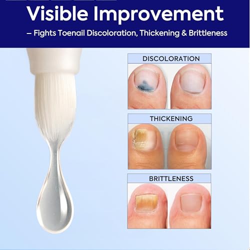 Extra Strength Nail Care Kit for Thick, Brittle Nails - Natural Formula