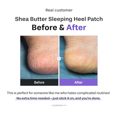 Baren Shea Butter Overnight Heel Patch - Cracked Heel Foot Mask (6 Pack)