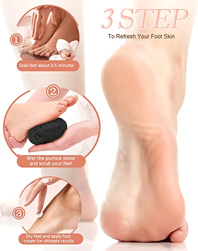 Maryton 2pcs Natural Lava Pumice Stones for Feet & Hands Callus Removal
