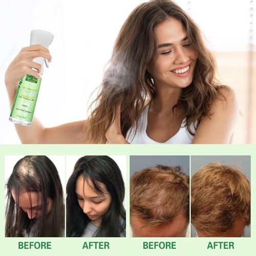 Rosemary Rice Water Hair Growth Spray - 10 fl oz