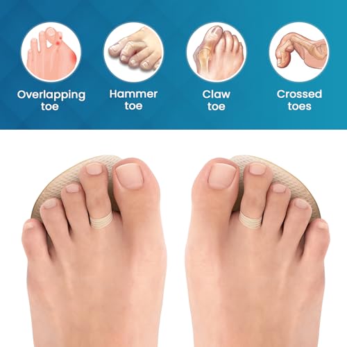 Kimihome 2-Pair Toe Straighteners for Crooked & Hammer Toes, Flexible Comfort, Beige