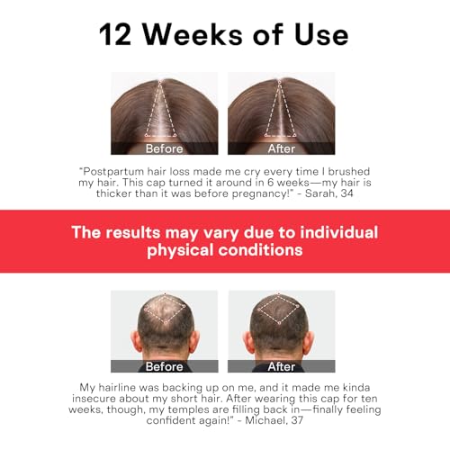 Red Light Therapy Hair Growth Cap for Men & Women