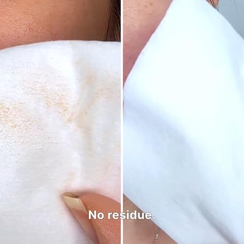 Aloe Fermentation Cleansing Milk, Hydrating Makeup Remover with Organic Aloe & Rice, Creamy Cleanser for Dry, Sensitive Skin, Supports Skin Barrier, Korean Skincare, 6.76 fl oz (200ml)