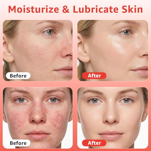 Red Light Therapy Serum, Red Light Therapy Activation Serums Amplify Effects & Reduce Wrinkles with Hydrating, Vitamin E Redlight Serum for Face, Rose Extract Facial Serums for Women, 1.0 FL.OZ