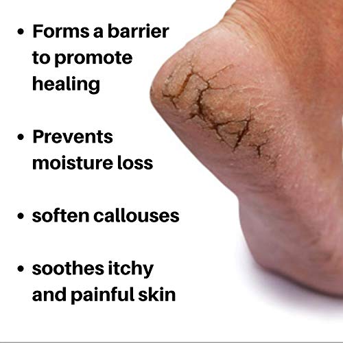 Nordic Care Foot Care Cream Intensive Repair | Urea & Glycerin Repairs Dry Feet & Cracked Heels | Noticeable Results In Days