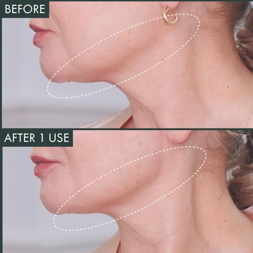 RéVive Neck & Chin Mask - Jawline Shaper for Toning & Defining