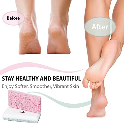 ZMOI 2-in-1 Siliglass Pumice Stone Callus Remover for Feet & Body