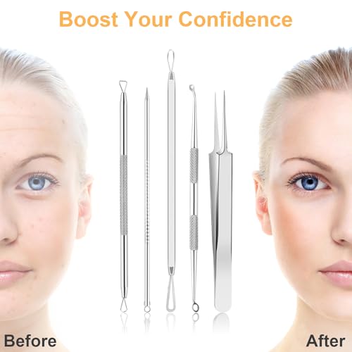 UUBAAR Blackhead Remover Kit, 9 Pimple Popper Tools with Tweezers