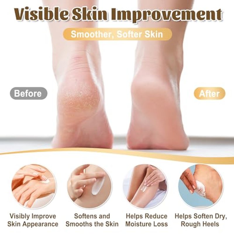 40% Urea Cream for Dry Cracked Heels & Feet