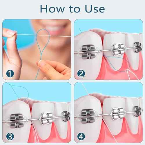 Floss Threaders Dental Floss Threader for Braces Bridges 400PCS(4Pack)