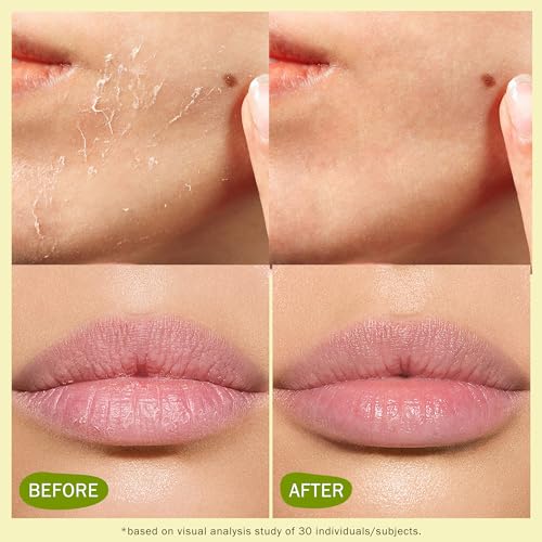 Beef Tallow for Skin: Organic Grass Fed Tallow Cream & Lip Balm Set ? Natural Dry Skin Moisturizer for Face, Body, Hands & Lips