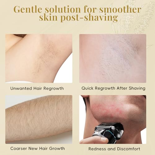 Cyperus Rotundus Roll-On Serum for Ingrown Hair & Razor Bumps