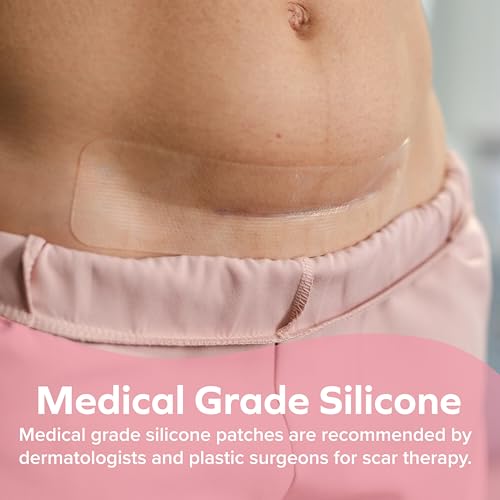 Dr. Talbot's C-Section Scar Strips - Medical Grade Silicone
