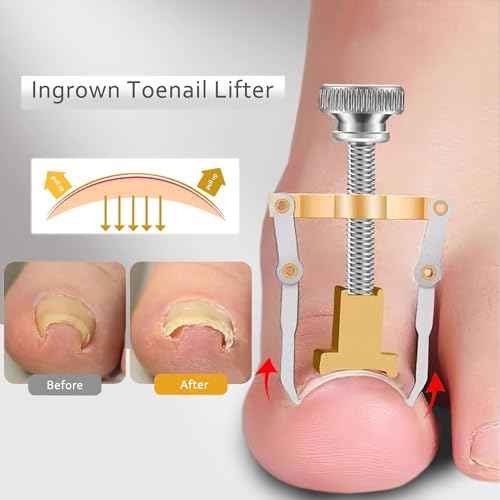 Toenail Clipper for Thick Nails Seniors Ingrown Toe Nail Pedicure Knife for Ingrown Nails Removal Kit Cutter Toenail Treatment Correction