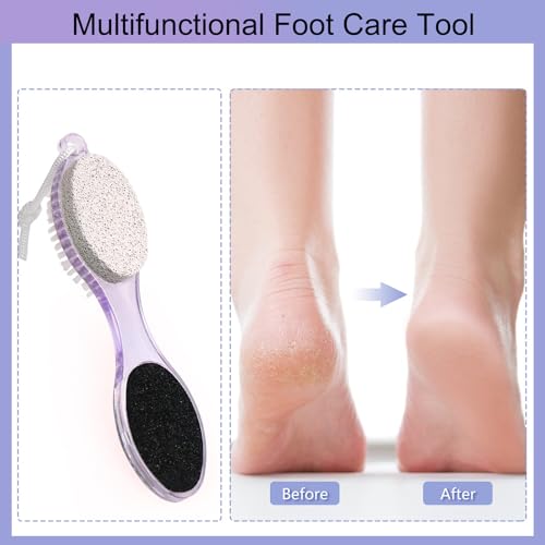 4-in-1 Foot Scrubber & Pumice Stone Pedicure Tool for Callus Removal - 2 Pack