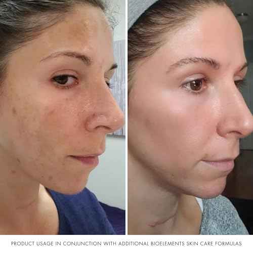 Bioelements Absolute Moisture - 2.5 oz - Lightweight Facial Moisturizer for Combination Skin - Smooth, Soft & Shine Free - Vegan, Gluten Free - Never Tested on Animals