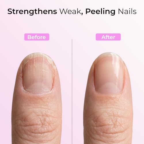 ORLY Nail Rescue Kit - 3-Step Repair for Broken & Cracked Nails