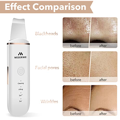 MISERWE Face Skin Scrubber - Deep Cleansing Spatula with 4 Modes