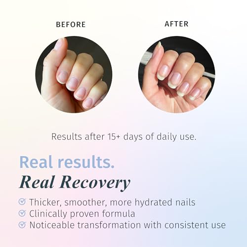 Duri Nail Growth System & 791 Berry Margarita Neon Purple Polish Set