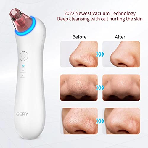 GERY Blackhead Remover Vacuum with 4 Probes & Red Blue Light