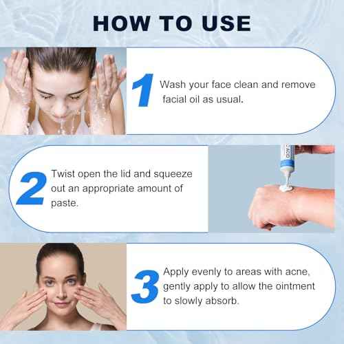 Azelaic Acid 10% Cream for Face - Acne Cream for Rosacea Reducing Relief Pimple Breakouts Blackhead Pigmentation and Redness - Azelaic Acid Gel For Facial and Skin Care