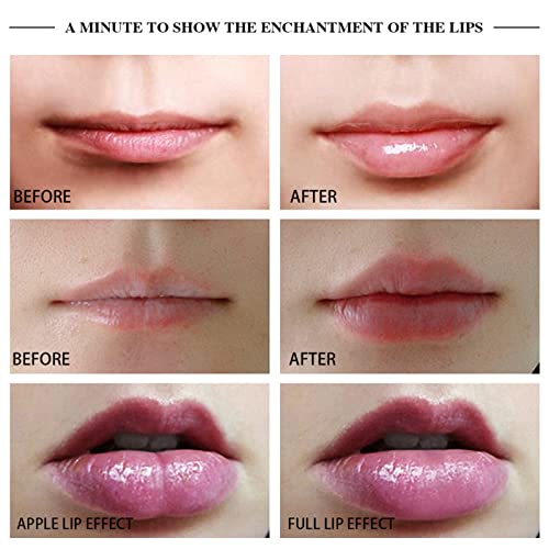 Electric Lip Plumper Tool, 450mAh Battery, Vacuum Suction