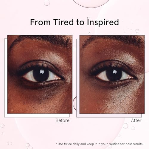 grace & stella Under Eye Brightener with Cooling Metal Rollerball - Centella Asiatica & Caffeine Eye Serum for Puffy Eyes - Travel Essentials - Under Eye Cream - Vegan Skincare (15ml / 0.51floz)