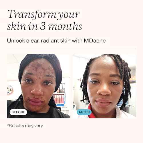 MDacne 3 Step Retinol Acne Kit - Retinol Cream 0.25%, Salicylic Acid Cleanser, Niacinamide Moisturizer - Plant-Based products for Hormonal Acne, Blemishes, and Wrinkles. 30 Day Complete Acne Care Kit