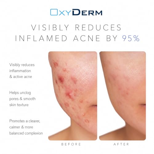 OxyDerm Acne Spot Treatment - Fast-Acting Invisible Formula