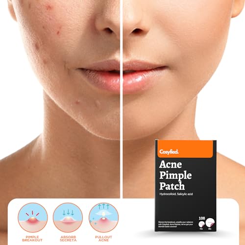 Cosyfied Acne Pimple Patch- Invisible Spot Cover for Face- Hydrocolloid Acne Pimple Patch for Covering Zits, Blemishes-Korean Skincare Tea Tree & Essential oils Spot Treatment-Acne Patches (108 dots)