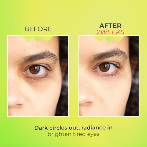 Look at Me Teen Again Dark Circle Eye Cream, Anti-Aging Line Smoothing Skin Care Treatment, Wrinkle Care, Cruelty Free, for Women and Men 0.84 fl. oz 25 ml