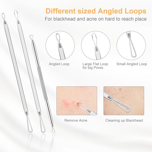 UUBAAR Blackhead Remover Kit, 9 Pimple Popper Tools with Tweezers