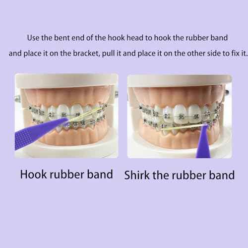 100PCS Elastic Rubber Bands Placers Tool for Braces,Colorful Disposable Plastic Orthodontic Elastic Placers Braces Rubber Band Tool