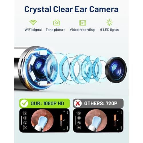 Ear Wax Removal - One-Hand Manual Ear Cleaner with Camera, 7 PCS Ear Spoons, Safe Ear Irrigation Kit for Adults (Black)