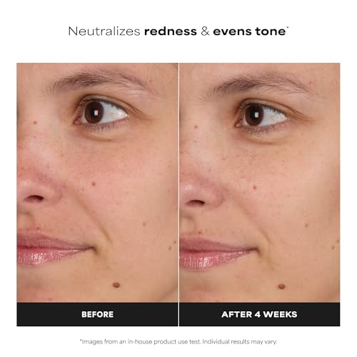 Paula's Choice Niacinamide Toner for Oily & Combination Skin